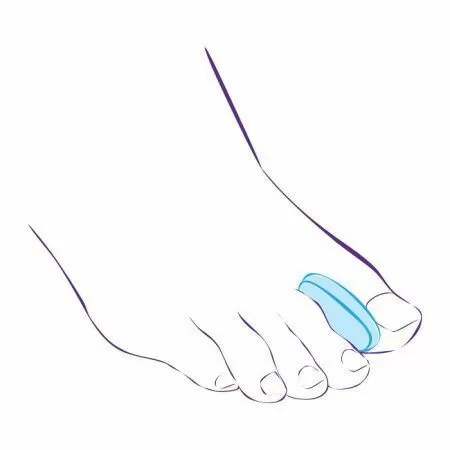 Разделитель межпальцевый Тривес СТ-32, силиконовый