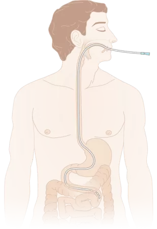 Зонд (катетер) дуоденальный с РКП MEDEREN 125 см закрытый конец 